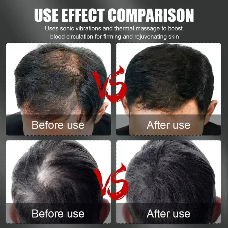 Gorro de Terapia Capilar con L - Hair Care reseña y precio